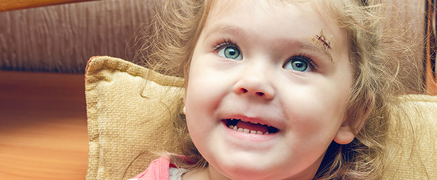 When to See a Doctor for a Cut or Laceration