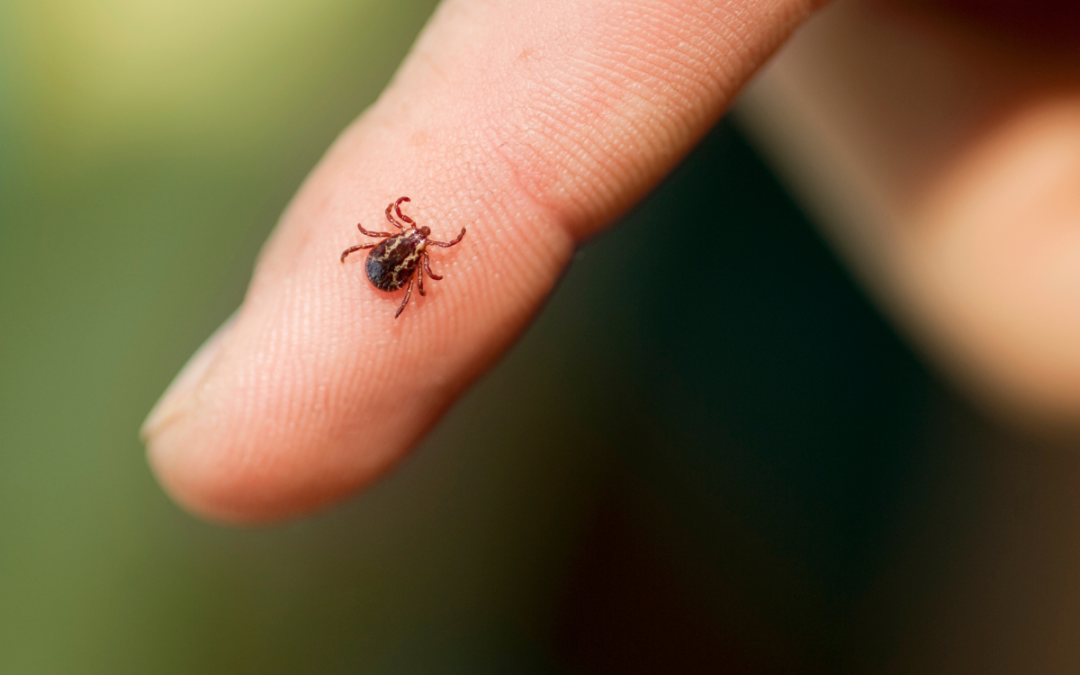 Rocky Mountain Spotted Fever: What You Need to Know